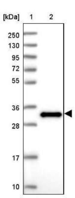EFHD2 Antibody, Novus Biologicals 0.1 mL; Unconjugated:Antibodies, Polyclonal