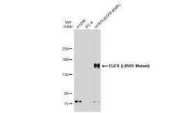 EGFR Antibody (HL1022) - L858R Mutant, Novus Biologicals 100 &mu;g | Buy Online | Novus Biologicals | Fisher Scientific