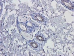 EGFR Antibody (Matuzumab) - Azide and BSA Free, Novus Biologicals 0.2 mg | Buy Online | Novus Biologicals | Fisher Scientific