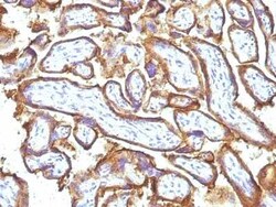 EGFR Antibody (31G7 + GFR1195), Novus Biologicals:Antibodies:Primary Antibodies
