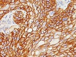 EGFR Antibody (GFR/1708), Novus Biologicals:Antibodies:Primary Antibodies