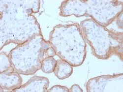 EGFR Antibody (GFR/1708), Novus Biologicals:Antibodies:Primary Antibodies