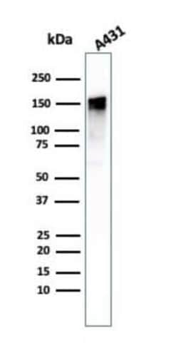 EGFR Antibody (GFR/1708), Novus Biologicals:Antibodies:Primary Antibodies