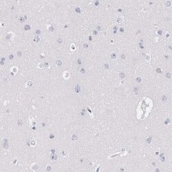 EGFR Antibody, Novus Biologicals:Antibodies:Primary Antibodies