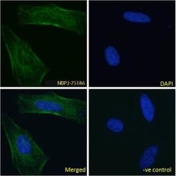 EGFR Antibody (h-R3 (Nimotuzumab)) - Azide and BSA Free, Novus Biologicals