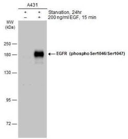 EGFR, p Ser1046, p Ser1047 Antibody, Novus Biologicals 100 &mu;g | Buy Online | Novus Biologicals | Fisher Scientific
