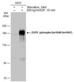 EGFR, p Ser1047, p Ser1046 Antibody, Novus Biologicals 100 &mu;g | Buy Online | Novus Biologicals | Fisher Scientific