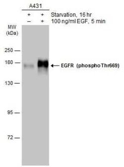 EGFR, p Thr669 Antibody, Novus Biologicals 100 &mu;g | Buy Online | Novus Biologicals | Fisher Scientific