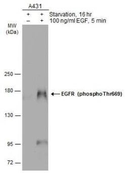 EGFR, p Thr669 Antibody, Novus Biologicals 100 &mu;g | Buy Online | Novus Biologicals | Fisher Scientific