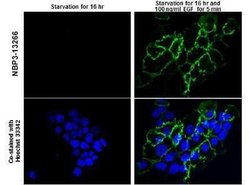 EGFR, p Tyr1045 Antibody, Novus Biologicals 100 &mu;g | Buy Online | Novus Biologicals | Fisher Scientific
