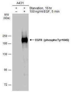 EGFR, p Tyr1045 Antibody, Novus Biologicals 100 &mu;g | Buy Online | Novus Biologicals | Fisher Scientific