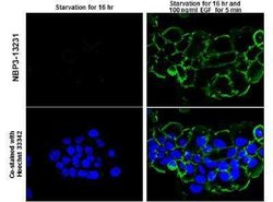 EGFR, p Tyr1148 Antibody, Novus Biologicals 100 &mu;g | Buy Online | Novus Biologicals | Fisher Scientific