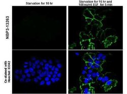 EGFR, p Tyr1148 Antibody, Novus Biologicals 100 μg; Unconjugated:Antibodies,