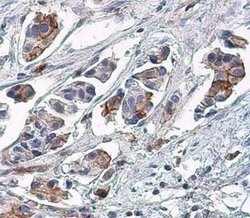 EGFR, p Tyr1148 Antibody, Novus Biologicals 100 &mu;g | Buy Online | Novus Biologicals | Fisher Scientific