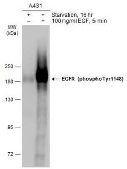 EGFR, p Tyr1148 Antibody, Novus Biologicals 100 &mu;g | Buy Online | Novus Biologicals | Fisher Scientific