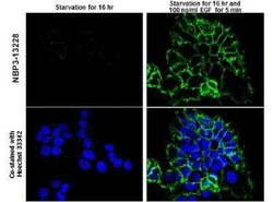 EGFR, p Tyr992 Antibody, Novus Biologicals 100 μg; Unconjugated:Antibodies,