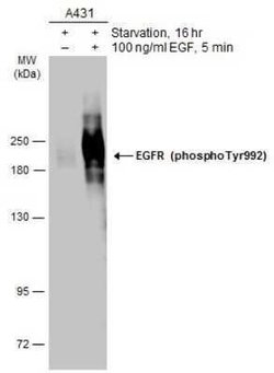 EGFR, p Tyr992 Antibody, Novus Biologicals 100 μg; Unconjugated:Antibodies,