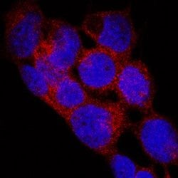 EGLN1/PHD2 Antibody (2445B) - BSA Free, Novus Biologicals:Antibodies:Primary