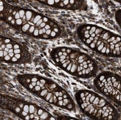 EGLN1/PHD2 Antibody, Novus Biologicals:Antibodies:Primary Antibodies
