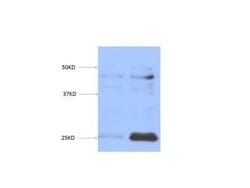 EGLN3/PHD3 Antibody (EG188e/d5) - Azide and BSA Free, Novus Biologicals 0.2 mL | Buy Online | Novus Biologicals | Fisher Scientific