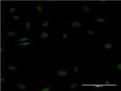 EGR1 Antibody (1F5), Novus Biologicals 0.1 mg | Buy Online | Novus Biologicals | Fisher Scientific