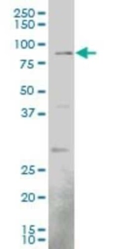 EGR1 Antibody (1F5), Novus Biologicals 0.1 mg | Buy Online | Novus Biologicals | Fisher Scientific