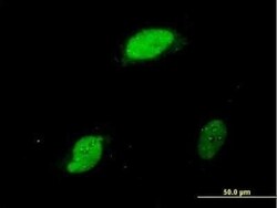 EGR1 Antibody (6E8), Novus Biologicals 0.1 mg | Buy Online | Novus Biologicals | Fisher Scientific