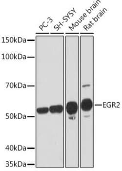 EGR2 Rabbit anti-Human, Mouse, Rat, Clone: 1F6V7, Novus Biologicals 100