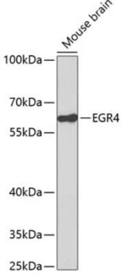 EGR4 Antibody - Azide and BSA Free, Novus Biologicals:Antibodies:Primary