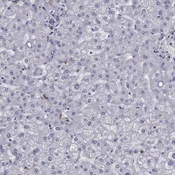 EHBP1L1 Rabbit anti-Human, Polyclonal, Novus Biologicals 100 &mu;g; Unconjugated:Antibodies,