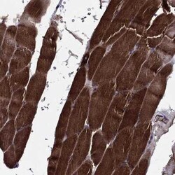EHBP1L1 Rabbit anti-Human, Polyclonal, Novus Biologicals 100 &mu;g; Unconjugated:Antibodies,