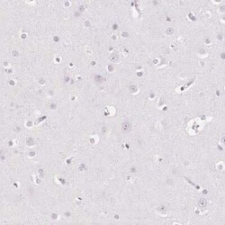 EHHADH Antibody, Novus Biologicals 25 &mu;L, Unconjugated:Antibodies, Polyclonal