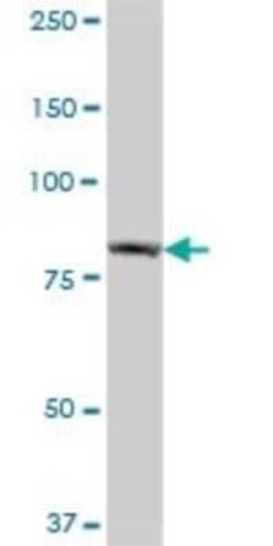 EHHADH Antibody, Novus Biologicals 50 &mu;g | Buy Online | Novus Biologicals | Fisher Scientific