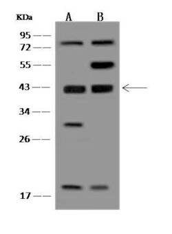 EI2BL Antibody, Novus Biologicals:Antibodies:Primary Antibodies