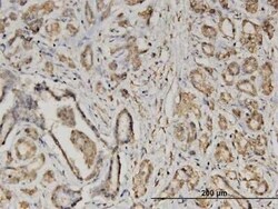 EIF2 beta Antibody (2F3), Novus Biologicals 0.1 mg | Buy Online | Novus Biologicals | Fisher Scientific