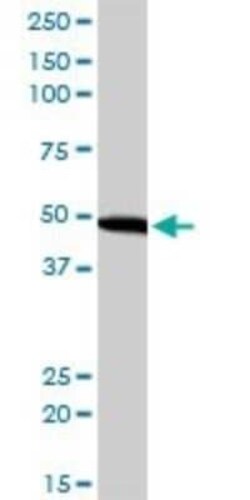 EIF2 beta Antibody (2F3), Novus Biologicals 0.1 mg | Buy Online | Novus Biologicals | Fisher Scientific