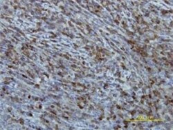 EIF2B2 Antibody (5B12-E10), Novus Biologicals 0.1 mg | Buy Online | Novus Biologicals | Fisher Scientific