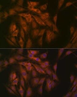 EIF3B Rabbit anti-Human, Mouse, Rat, Clone: 4T9V1, Novus Biologicals 20