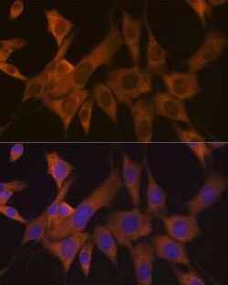 EIF3B Rabbit anti-Human, Mouse, Rat, Clone: 4T9V1, Novus Biologicals 20