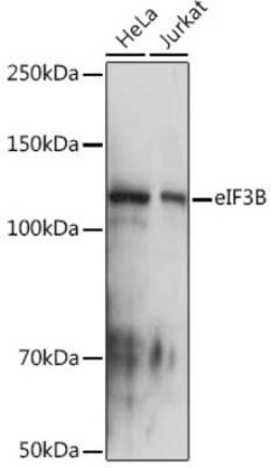 EIF3B Rabbit anti-Human, Mouse, Rat, Clone: 4T9V1, Novus Biologicals 20