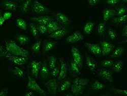 EIF3F Antibody, Novus Biologicals 100 &mu;g, Unconjugated:Antibodies, Polyclonal