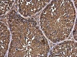 EIF3S3 Antibody (GT35512), Novus Biologicals 100 &mu;g; Unconjugated:Antibodies,