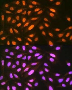 EIF4A3 Rabbit anti-Human, Mouse, Rat, Clone: 6Y3N4, Novus Biologicals 20 &mu;g | Buy Online | Novus Biologicals | Fisher Scientific