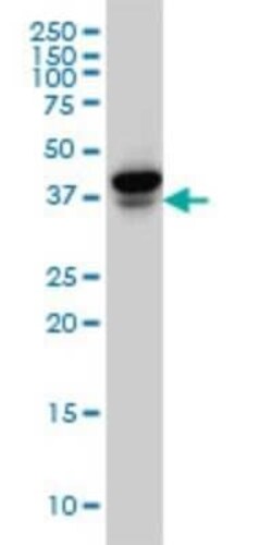 EIF4E2 Antibody (1A11), Novus Biologicals 0.1 mg | Buy Online | Novus Biologicals | Fisher Scientific