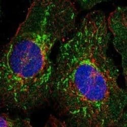 EIF4E2 Rabbit anti-Human, Polyclonal, Novus Biologicals 100 &mu;g; Unconjugated:Antibodies,