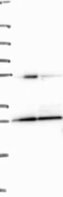 EIF4E2 Rabbit anti-Human, Polyclonal, Novus Biologicals 100 &mu;g; Unconjugated:Antibodies,