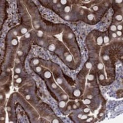 EIF4E3 Rabbit anti-Human, Polyclonal, Novus Biologicals 25 &mu;g | Buy Online | Novus Biologicals | Fisher Scientific