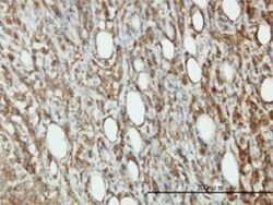 EIF5 Antibody (2E6-4C12), Novus Biologicals 0.1 mg | Buy Online | Novus Biologicals | Fisher Scientific