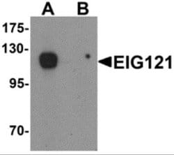EIG121 Antibody - BSA Free, Novus Biologicals 0.1 mg | Buy Online | Novus Biologicals | Fisher Scientific
