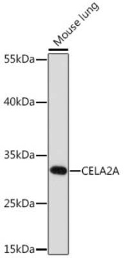ELA2A Rabbit anti-Mouse, Rat, Polyclonal, Novus Biologicals:Antibodies:Primary